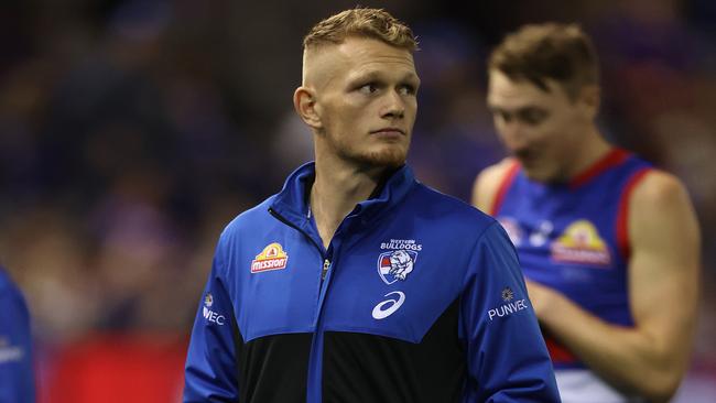 Injured Bulldog Adam Treloar will miss up to two months of footy.