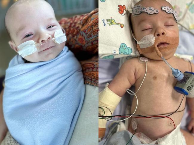 A Logan mother has revealed the scrambling and desperate minutes that followed her newborn turning blue, and his ongoing battle with multiple surgeries for his “different anatomy”. 