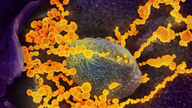 The coronavirus (yellow objects) is seen through an electron microscope. Picture: Supplied