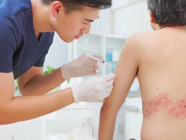 close up asian male doctor is giving man patient an injection shot about his shingles disease on skin   i stock image