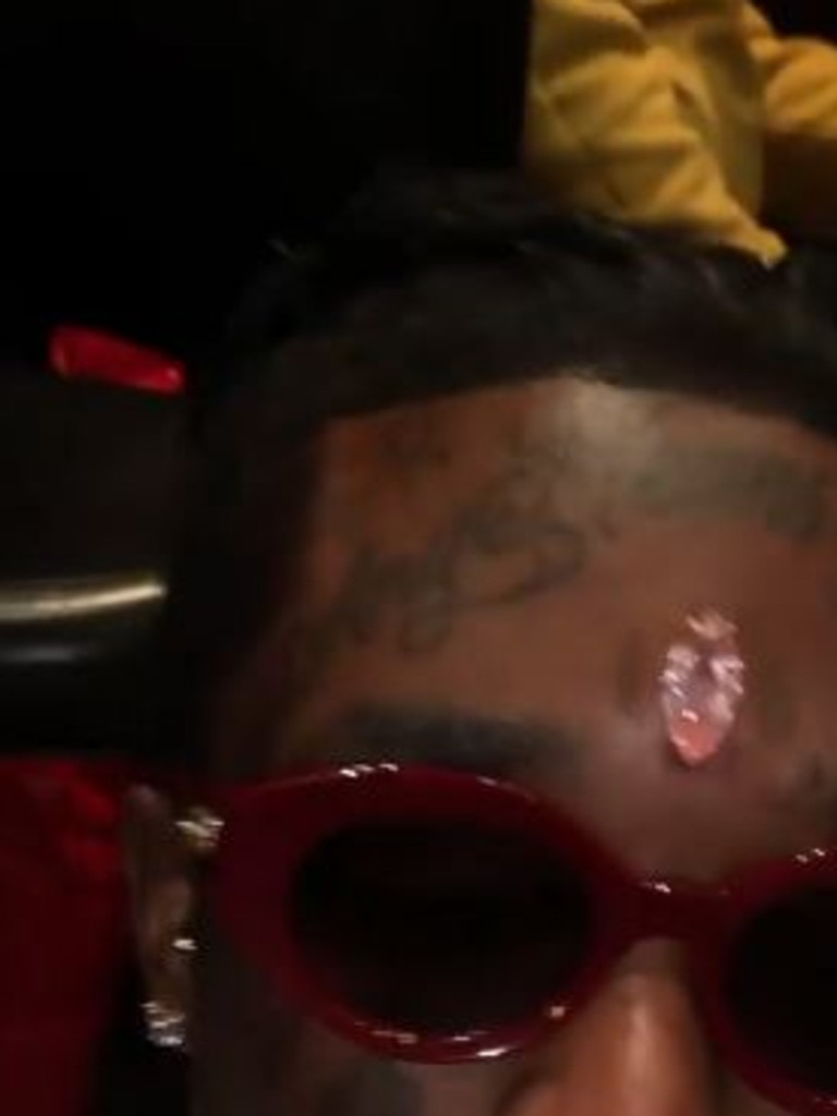 Rapper Lil Uzi Gets 31 Million Diamond Implant In Forehead Daily 4140