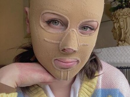 The 26-year-old wearing her compression mask to heal her burns scars. Picture: Instagram