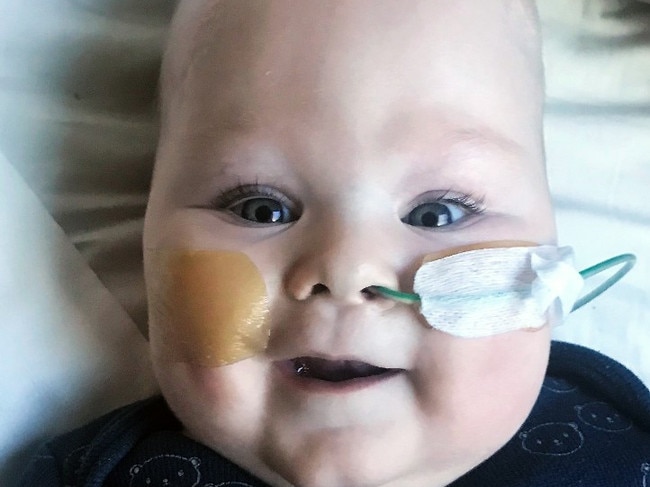 Meet Harvey, of Logan, our smile of the week 😄. Harvey hasn't had the smoothest start to life, having been born prematurely at 29 weeks and diagnosed with a range of complex conditions and hydrocephalus (a build-up of fluid in the brain). Now 10 months, he's been at the Queensland Children's Hospital since March and undergone several surgeries including neurosurgery and an operation to re-join his oesophagus. This Wednesday marked Harvey's 160th day 🗓️ at Queensland Children's Hospital - but also the day he got to go home with his mum and dad for the first time. 🏡💛 Harvey will require further surgeries in the future and ongoing support from our allied health teams, but for now he's enjoying the world that awaits him outside a hospital room and playing with his big brother Freddie. Enjoy being home, Harvey - we're all so proud of how far you've come Picture Faccebook/Children's Health Queensland