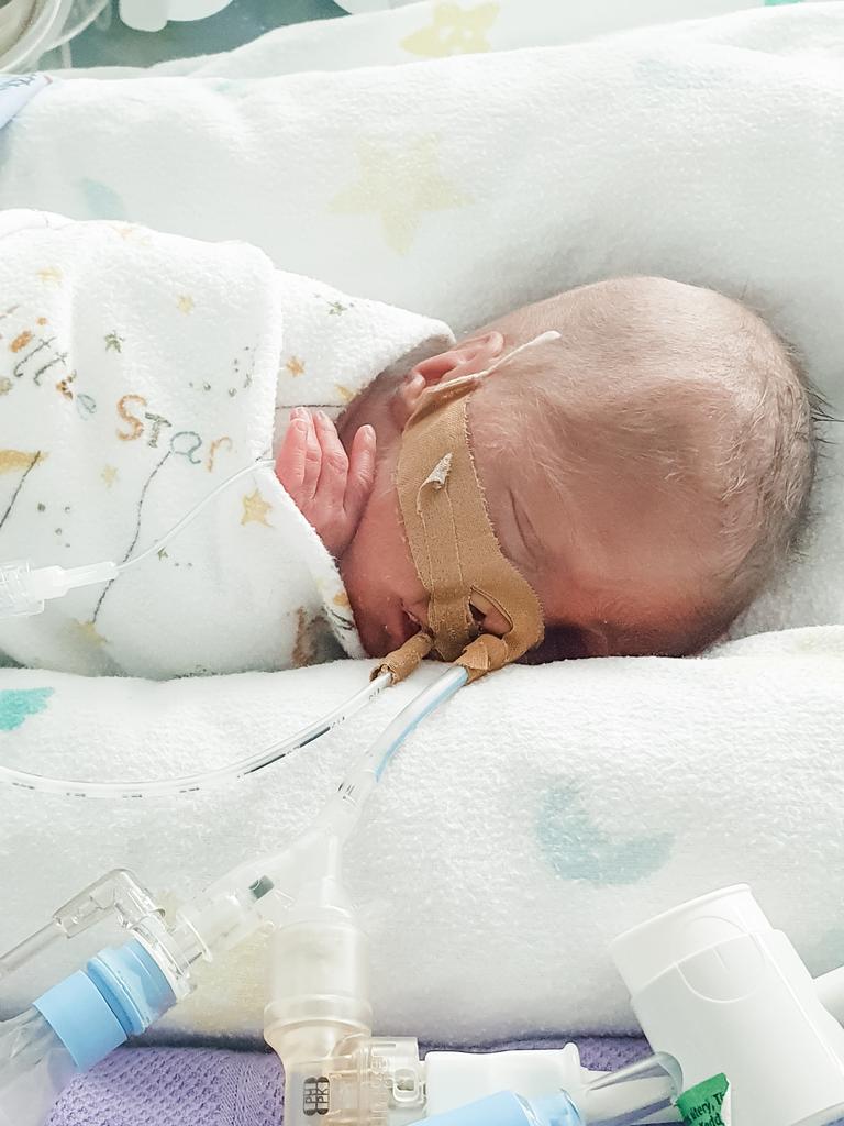 Alexander (850g) was admitted to the neonatal intensive care unit (NICU). Picture: Supplied.