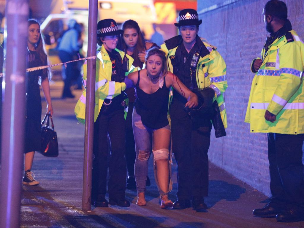 An injured woman seen near Manchester Arena after reports of an explosion during an Ariana Grande concert. Picture: Joel Goodman/LNP