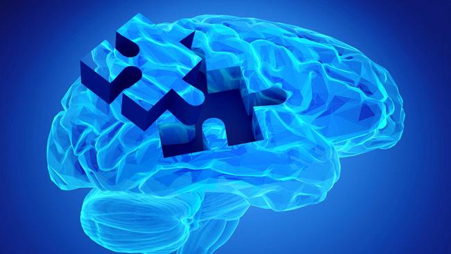 The Tasmanian-developed test could predict dementia in people “20 years before the person becomes aware of any cognitive symptoms”.