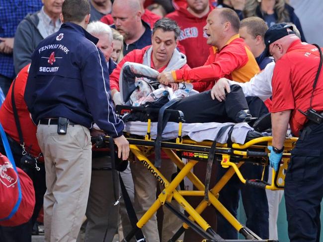 Police say the fan has life threatening injuries.