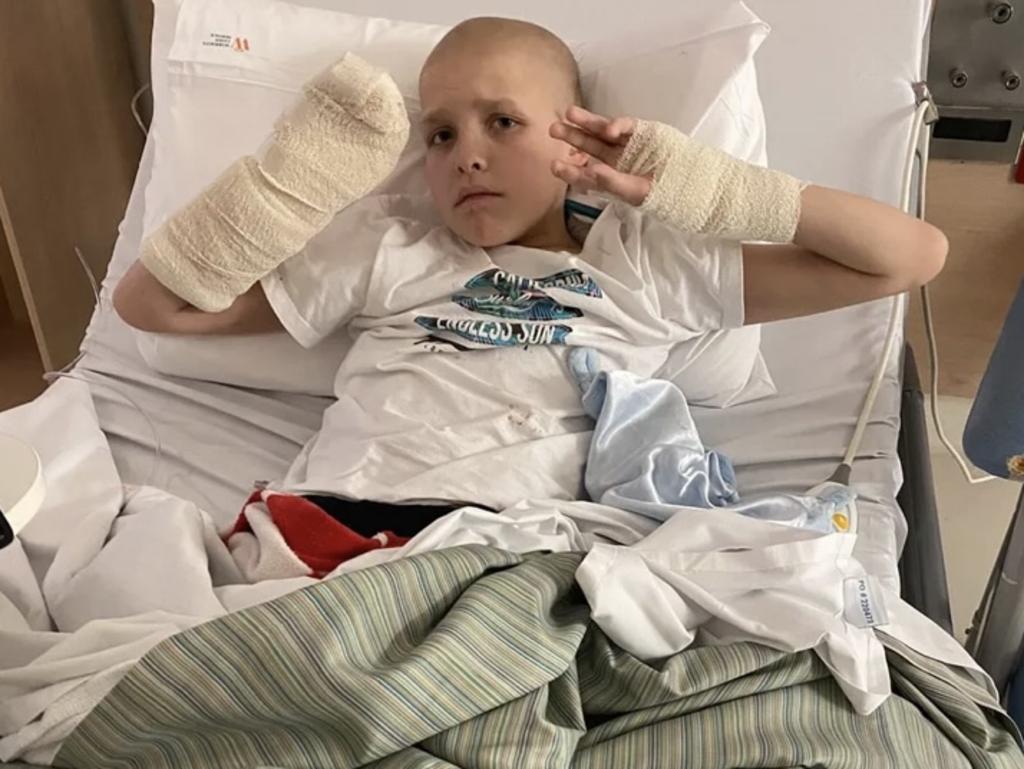 Thomas Hood, couldn’t cut his 11th birthday cake because his hands were so heavily bandaged. Picture: Supplied