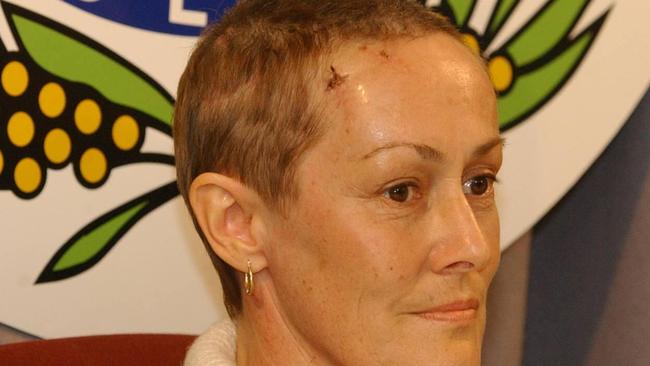 Nanette Clarke pictured after the 2003 attack during a police appeal for information. Photo: Mike Burton.