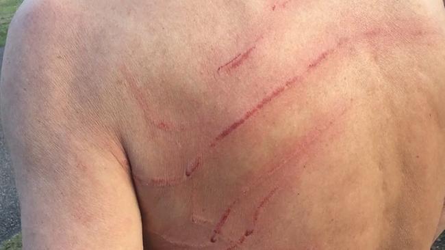 A man’s scars after being attacked by a kangaroo. Picture: Facebook