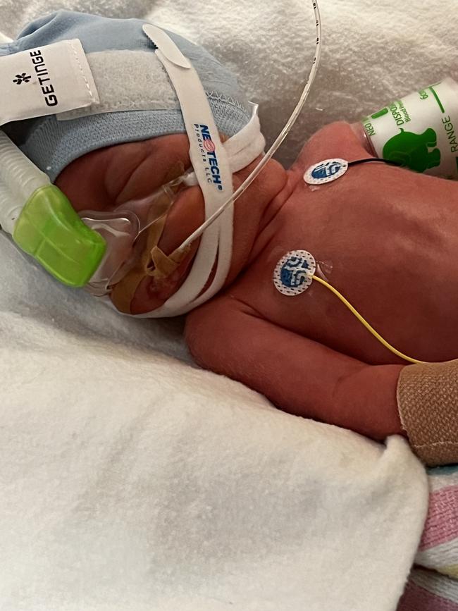 Indigo Daisy Murray was born 10 weeks premature on June 15 2023 and has experienced health complications since birth. Picture: Supplied by family