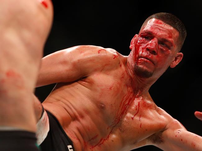 Nate Diaz kicks was a mess by Round 3.