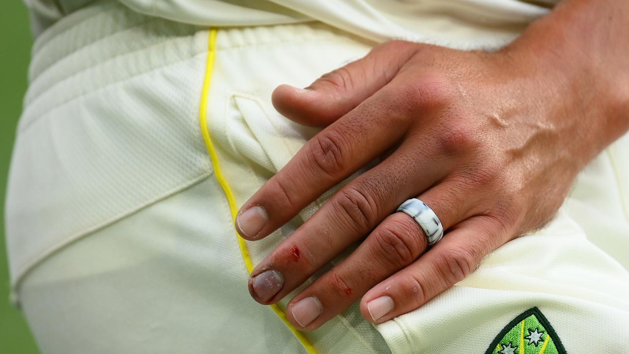 The hand of Mitchell Starc seen during day three.