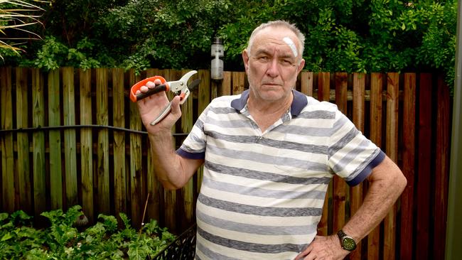 Alan Thomson was allegedly punched by his neighbour in a dispute over an overgrown hedge and had to be taken to hospital. Picture: Evan Morgan