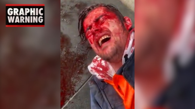 Man lies bleeding during Melbourne protest