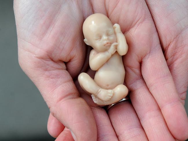 Life-size models of a foetus at 14 weeks. Picture: AAP Image/Julian Smith