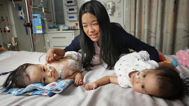 The formerly-conjoined twins Nima and Dawa with their mum Bhumchu. Picture: Alex Coppel