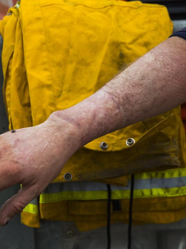 Mr O'Keeffe bares the scars of what happened the day Sam McPaul was killed. Picture: Dylan Robinson