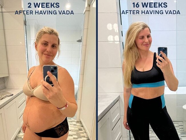 Tiff Hall has shared her post-baby transformation on Instagram. Picture: Instagram/Tiff Hall