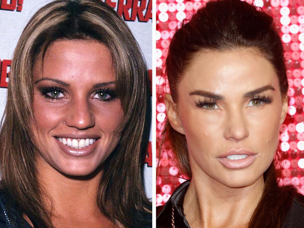 Katie Price has never been shy about revealing information about what surgeries she’s had. Picture: Getty Images