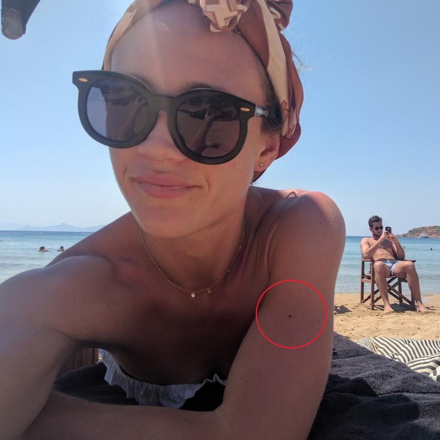 Jade Offord, 27, of Wollongong, Sydney, noticed a tiny spot on her left arm last year. Picture: Instagram / Jade Offord