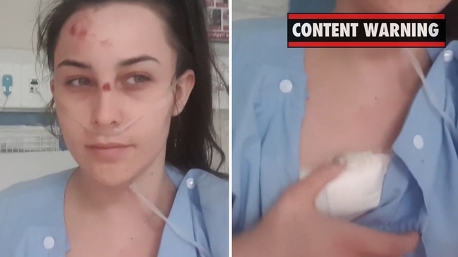 Teen stabbed by ex shows off huge wound in hospital