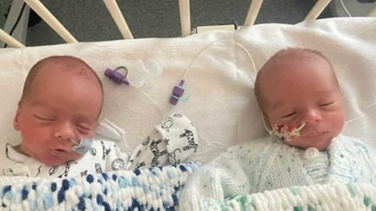 Jacob and Jaxon were born on July 5. Picture: University Hospitals of North Midlands