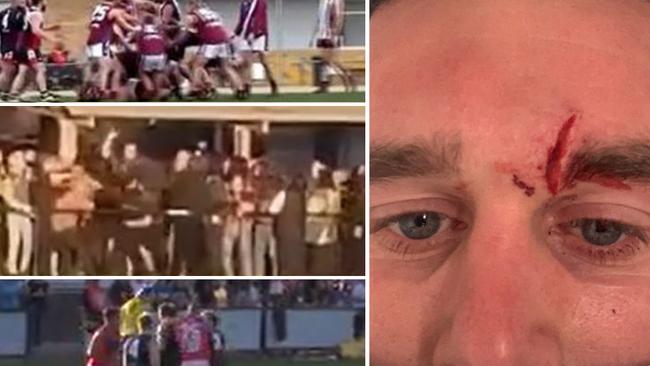 Physical contact on the footy field is to be expected. Most of the time it’s part of the rough and tumble of the game — but there times when it goes too far.