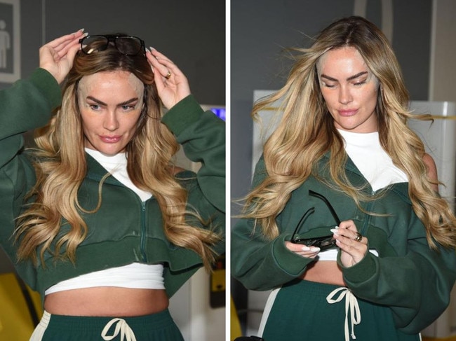 MAFS star spotted after cosmetic surgery