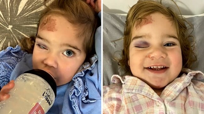 Ella is on the mend, but her injuries could have been far worse. Picture: A Current Affair