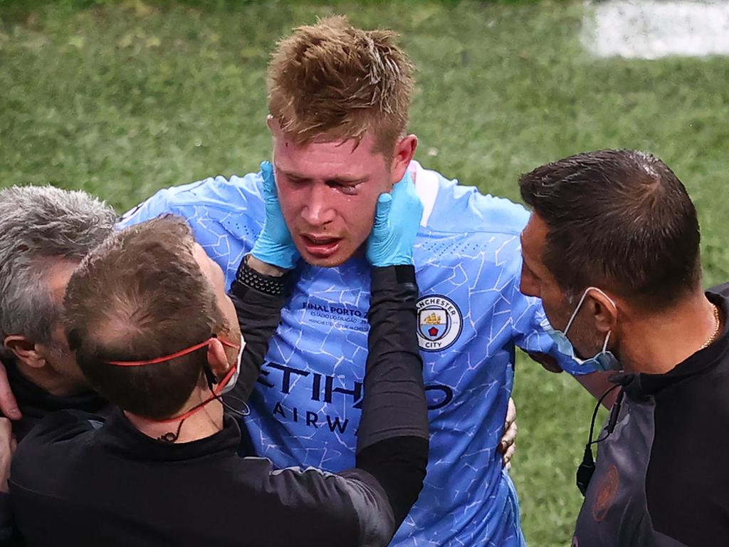 De Bruyne had a black eye and was crying. (Photo by MICHAEL STEELE / POOL / AFP)