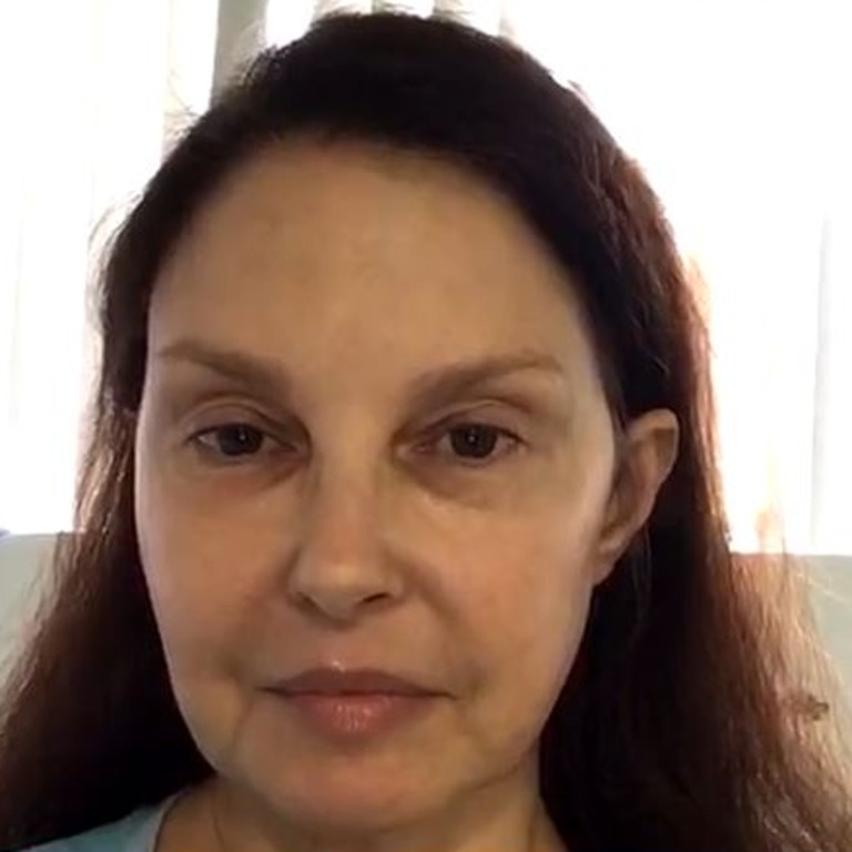 Ashley Judd Actress In African Icu After Shattering Leg In The Remote Congo The Advertiser 9286