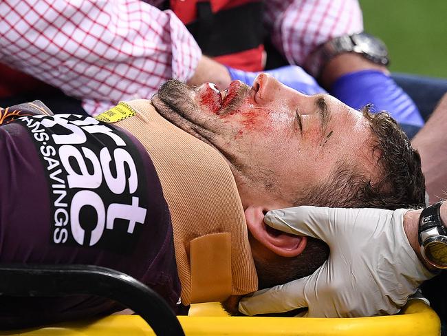 Broncos player Corey Oates is taken from the field in a neck brace after sustaining an injury during the NRL Semi-Final between the Brisbane Bronco's and the Penrith Panthers in Brisbane, Friday, September  15, 2017.  (AAP Image/Dave Hunt) NO ARCHIVING