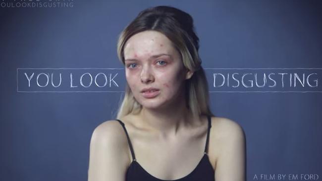 Em Fords You Look Disgusting Video My Pale Skin Au — Australias Leading News Site 