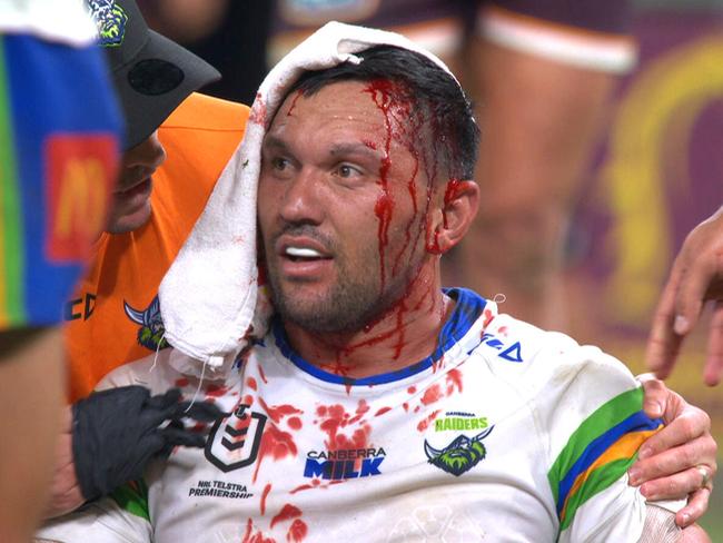 Sickening ‘horror movie’ scene splits NRL