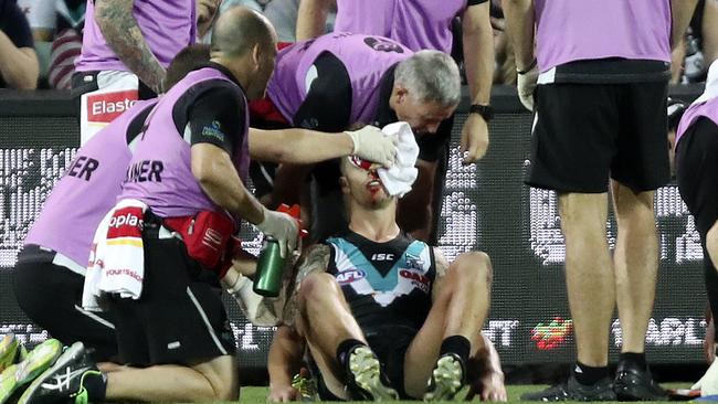 Hamish Hartlett being attended to after cutting his head in a clash with Dangerfield.