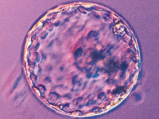 Blastocyst, multi-cell embryo. fertilized egg
