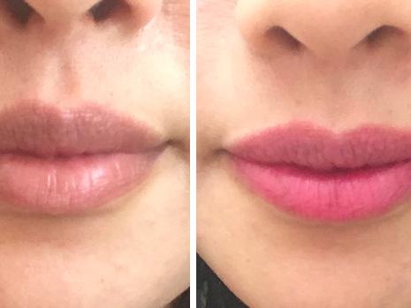 Carla's lips, before and after. Picture: Supplied