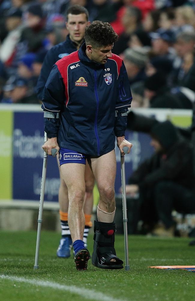 Tom Liberatore on crutches and in a moon boot last Friday night. Picture: Wayne Ludbey