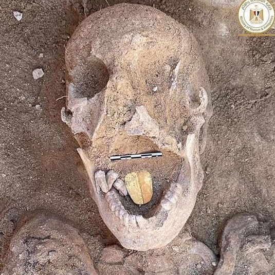 This ancient Egyptian man was buried with a golden tongue. Picture: Egypt Ministry of Tourism and Antiques