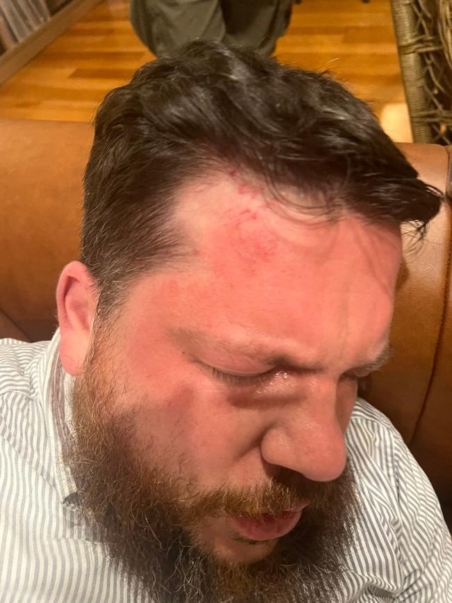 Leonid Volkov’s wife posted a picture of her husband’s injuries on Twitter/X after he was attacked with a hammer. Picture: AFP/Getty Images