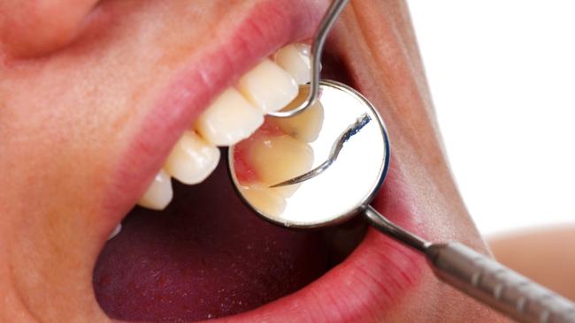 Generic image of dentist working on teeth with mirror.