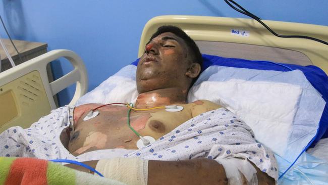 A man wounded during Israeli bombardment rests at a hospital in the southern Lebanese village of Saksaqiyeh. Picture: AFP