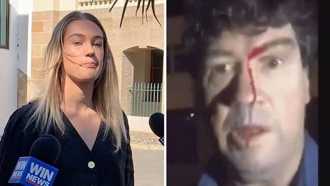 Casey Holmes has indicated she will plead guilty to assault. Picture: supplied