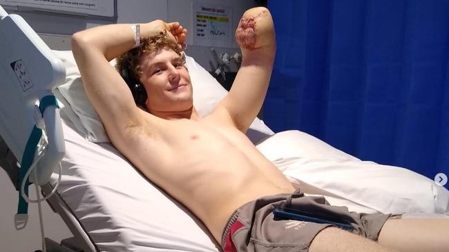 British backpacker Henry Dunn lost his lower left arm after a workplace accident on a remote Northern Territory cattle station.