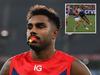 ‘Human missile’: Star’s moment of chaos