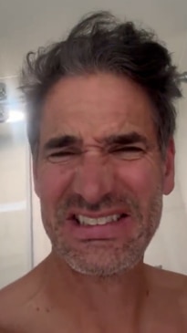 Too graphic for TV: Todd Sampson shows off horror results of "wellness treatment"