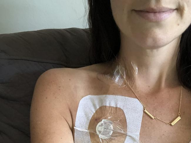 Emma Gorrick, 35, of Cromer, was told she has just months to live, is trying to keep healthy with a regimen of natural therapies including IV vitamin infusions. Picture: Supplied.