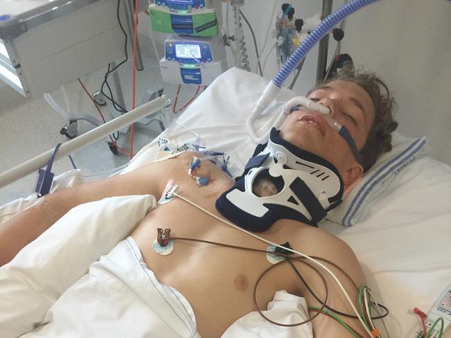 Alex Noble in a four-day coma in the intensive care unit at Royal North Shore Hospital after and eight-hour spinal surgery. Photo: Supplied