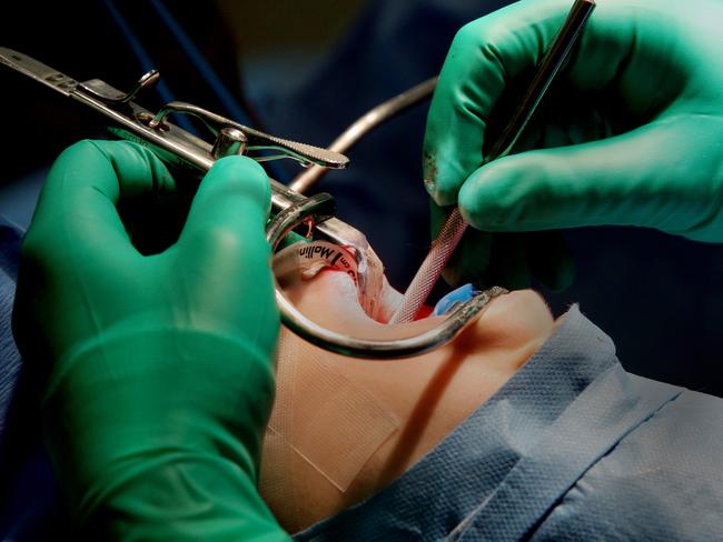 Dental work or having your tonsils out can keep you off a flight. Picture: News Corp